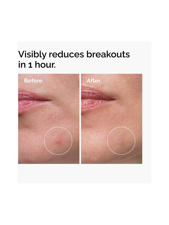 The Ordinary - Sulfur 10% Powder-to-Cream Concentrate -tehohoito - NOCOL | Stockmann - photo 3