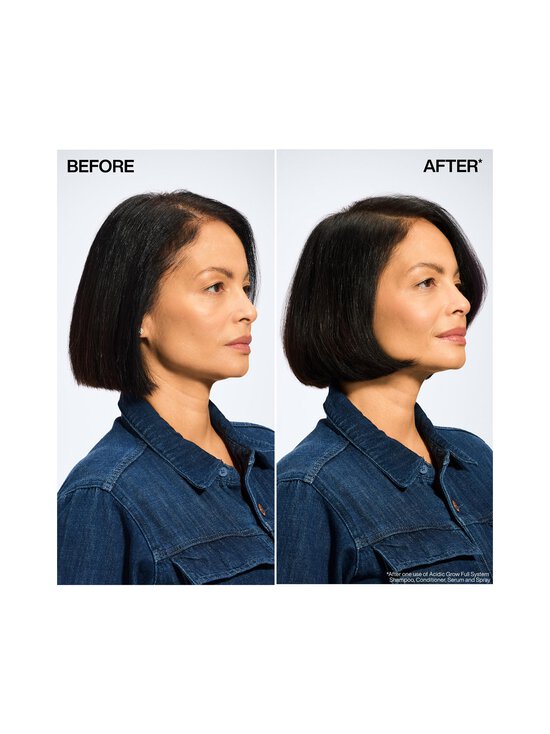 Redken - Acidic Grow Full System Scalp & Hair Serum -seerumi 100 ml - NOCOL | Stockmann - photo 4