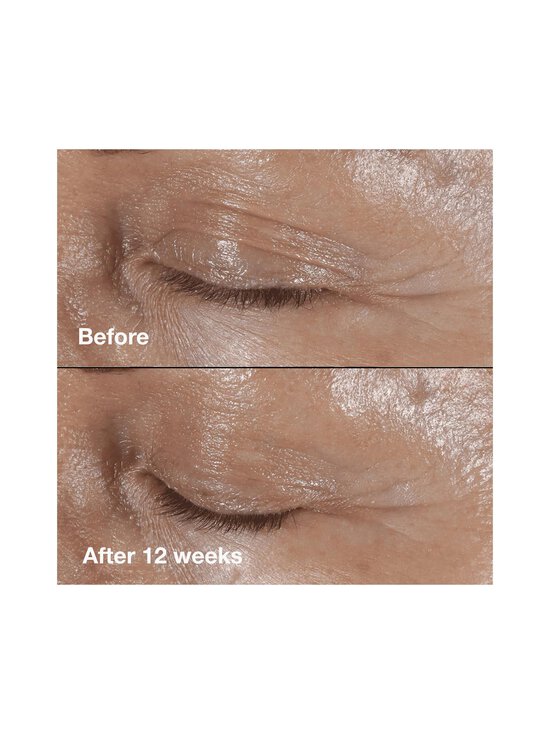 Clinique - Smart Clinicial Repair Wrinkle Correcting Eye Cream -silmänympärysvoide 15 ml - NOCOL - photo 10 Clinique - Smart Clinicial Repair Wrinkle Correcting Eye Cream -silmänympärysvoide 15 ml - NOCOL | Stockmann - photo 10
