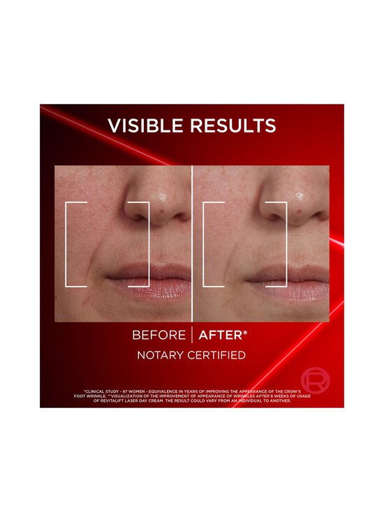 L'Oréal Paris - Laser Day Cream for all skin types -päivävoide | Stockmann - photo 4