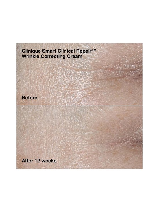 Clinique - Wrinkle-Correcting Routine Set ādas kopšanas komplekts - NOCOL | Stockmann - photo 3