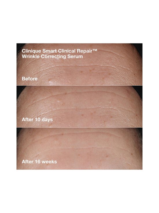 Clinique - Wrinkle-Correcting Routine Set ādas kopšanas komplekts - NOCOL | Stockmann - photo 4