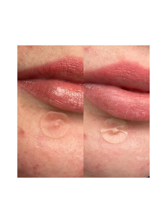 Hero - Nahaplaaster Mighty Patch Invisible+,  24 tk - NOCOL | Stockmann - photo 3