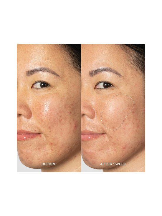 Ole Henriksen - Glow2oh™ Dark Spot Toner 198 ml - NOCOL - photo 4 Ole Henriksen - Glow2oh™ Dark Spot Toner 198 ml - NOCOL | Stockmann - photo 4