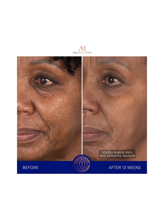 Augustinus Bader - The Face Cream Mask -kasvonaamio - NOCOL - photo 3 Augustinus Bader - The Face Cream Mask -kasvonaamio - NOCOL | Stockmann - photo 3