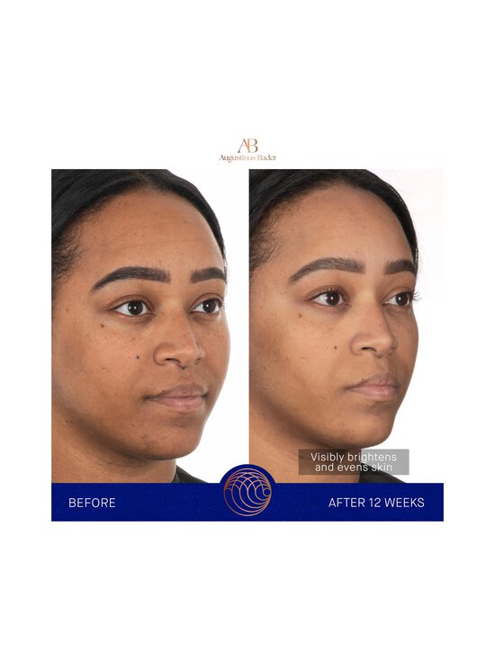 Augustinus Bader - The Face Cream Mask -kasvonaamio - NOCOL - photo 4 Augustinus Bader - The Face Cream Mask -kasvonaamio - NOCOL | Stockmann - photo 4