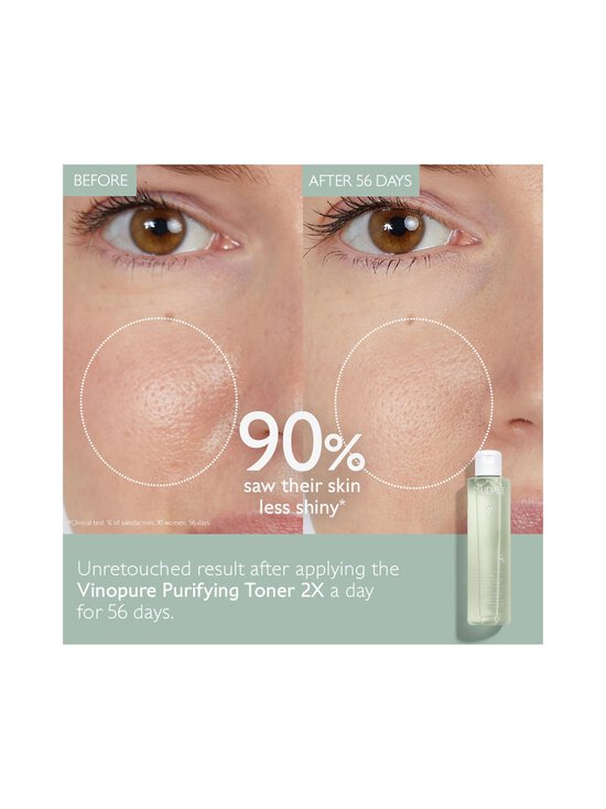 Caudalie - Näovesi Vinopure Purifying Toner 200 ml - NOCOL - photo 2 Caudalie - Näovesi Vinopure Purifying Toner 200 ml - NOCOL | Stockmann - photo 2