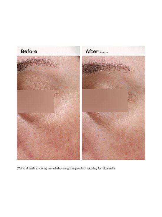 The Ordinary - Niacinimide 5% Face & Body Emulsion -voide 100 ml - NOCOL - photo 3 The Ordinary - Niacinimide 5% Face & Body Emulsion -voide 100 ml - NOCOL | Stockmann - photo 3