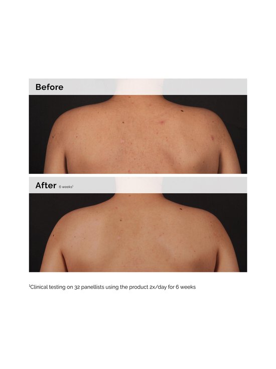 The Ordinary - Salicylic Acid 0.5% -kuoriva vartaloseerumi 240 ml - NOCOL | Stockmann - photo 3