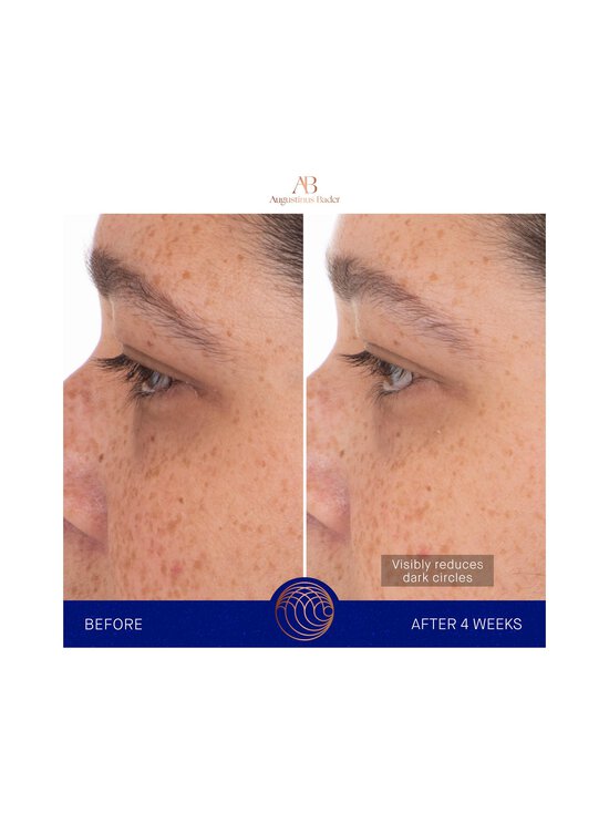 Augustinus Bader - Silmamask The Eye Patches - NOCOL - photo 3 Augustinus Bader - Silmamask The Eye Patches - NOCOL | Stockmann - photo 3