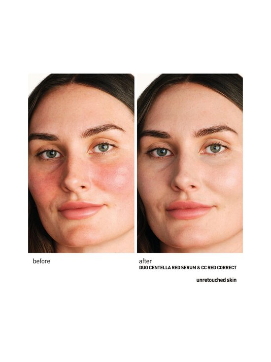 Erborian - Centella Red Serum -seerumi, 30 ml - NOCOL | Stockmann - photo 2