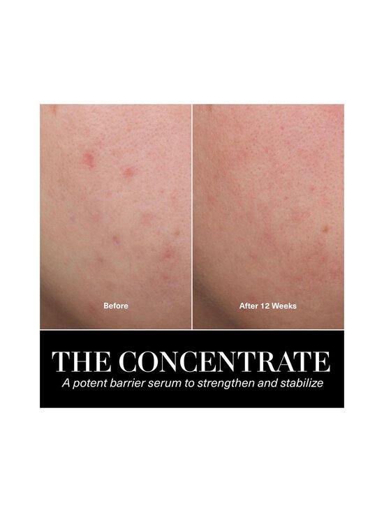 La Mer - The Concentrate dienas krēms 50 ml - NOCOL | Stockmann - photo 5