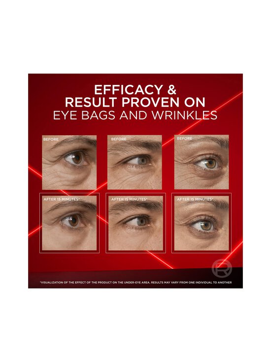 L'Oréal Paris - Revitalift Laser Eye Bag Instant Eraser - geelimäinen silmänympärysvoide - NOCOL | Stockmann - photo 4