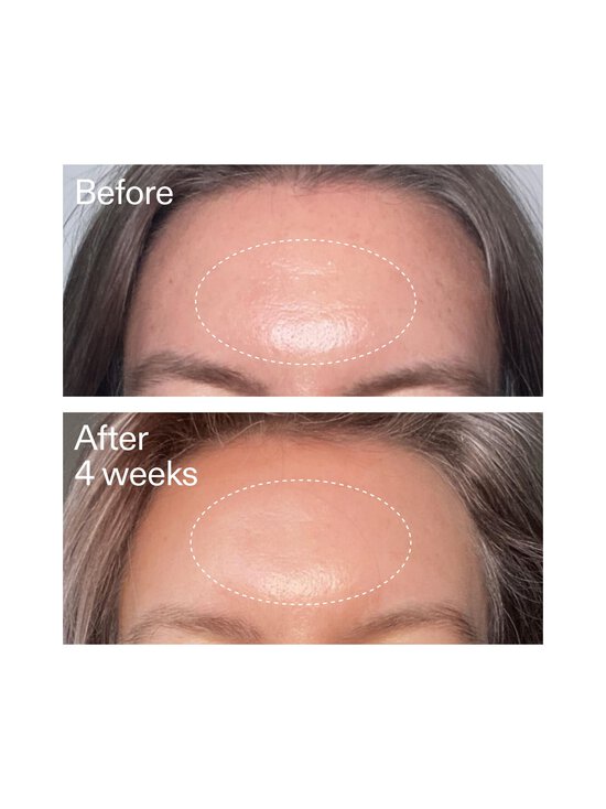 The Inkey List - Advanced Retinal Serum -seeurmi, 15 ml - NOCOL | Stockmann - photo 8