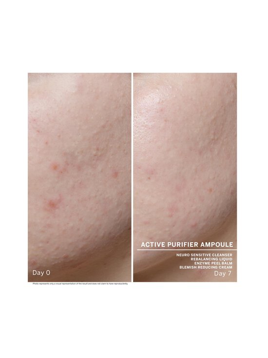 Babor - Ampoule Concentrates Active Purifier ampulas 7 x 2 ml - NOCOL - photo 8 Babor - Ampoule Concentrates Active Purifier ampulas 7 x 2 ml - NOCOL | Stockmann - photo 8