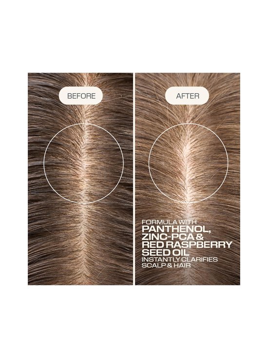 Goldwell - Dualsenses Scalp Specialist Clarifying -shampoo - NOCOL | Stockmann - photo 7