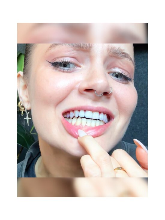 Hismile - V34 Teeth Whitening  Strips -valkaisuliuskat 14-pack - NOCOL | Stockmann - photo 3
