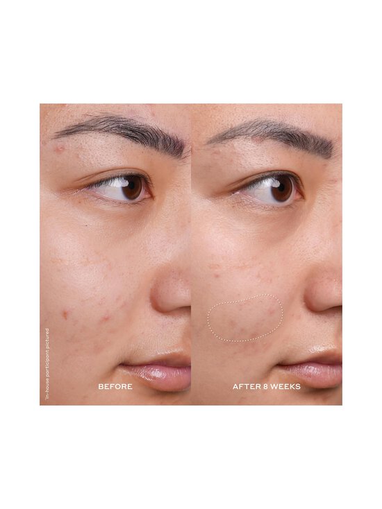 Ole Henriksen - Seerum Banana Bright ™ Vitamin C 30 ml - NOCOL - photo 3 Ole Henriksen - Seerum Banana Bright ™ Vitamin C 30 ml - NOCOL | Stockmann - photo 3