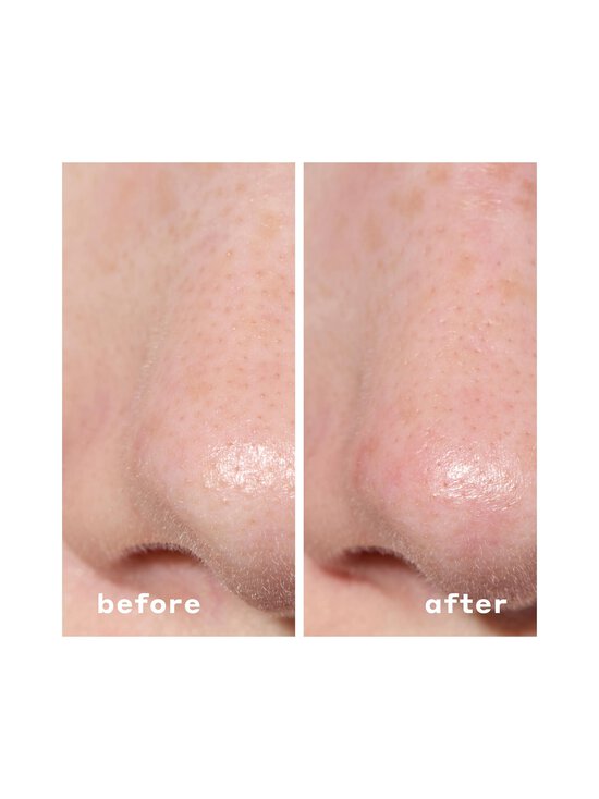 Mario Badescu - Nahahoolduskomplekt Deep Cleansing Pore Strip - NO COL | Stockmann - photo 6