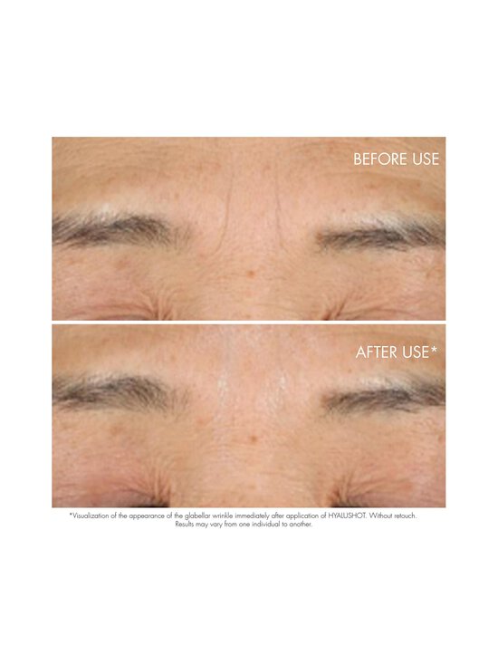 DIOR - Capture Totale Hyalushot Concentre Tube -kasvovoide - NOCOL | Stockmann - photo 3