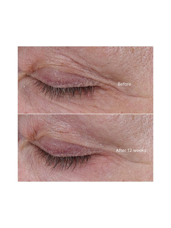 La Mer - The Rejuvenating Eye Cream -silmänympärysvoide - NOCOL | Stockmann - photo 5