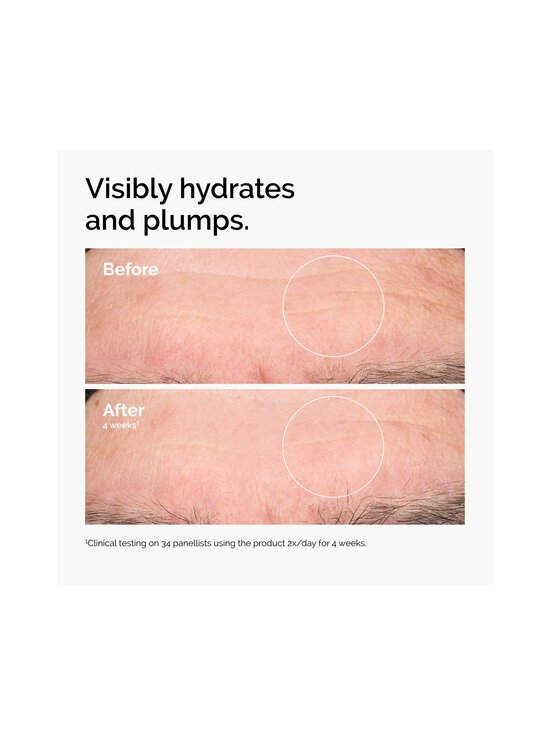 The Ordinary - Hyaluronic Acid 2% + B5 -seerumi 120 ml - NOCOL | Stockmann - photo 3