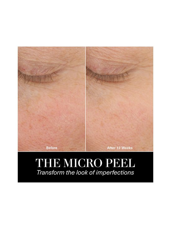 La Mer - Seerum The Micro Peel - NOCOL | Stockmann - photo 4
