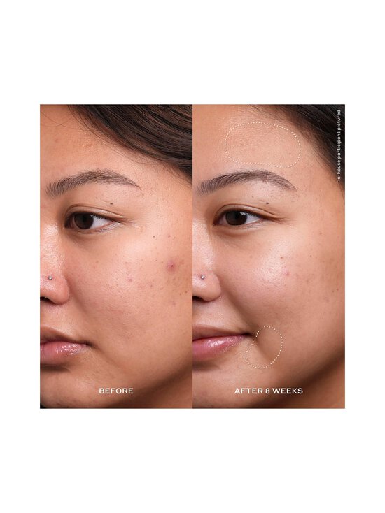 Ole Henriksen - Seerum Transform Dewtopia 20% Acid Treatment 30 ml - NOCOL - photo 9 Ole Henriksen - Seerum Transform Dewtopia 20% Acid Treatment 30 ml - NOCOL | Stockmann - photo 9