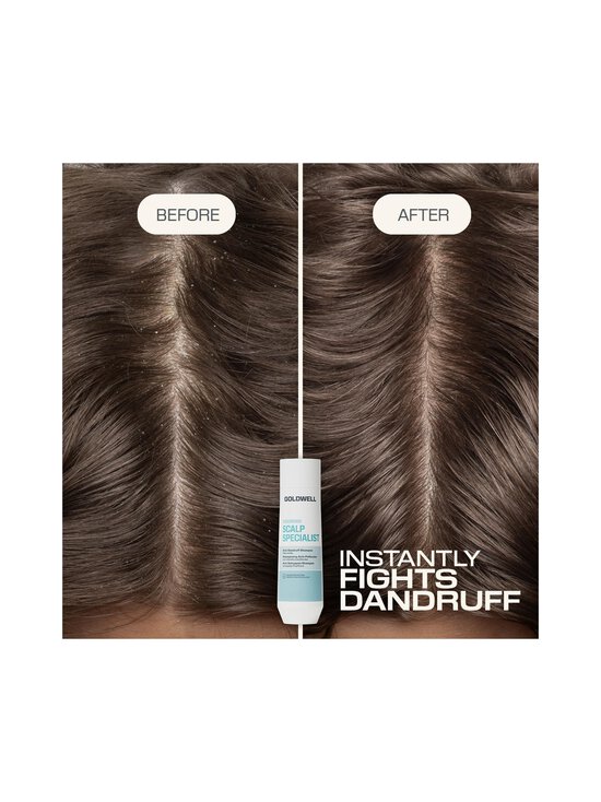 Goldwell - Dualsenses Scalp Specialist Anti-Dandruff šampūns - NOCOL | Stockmann - photo 3