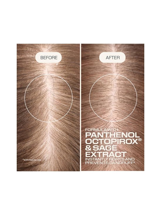 Goldwell - Dualsenses Scalp Specialist Anti-Dandruff šampūns - NOCOL | Stockmann - photo 7