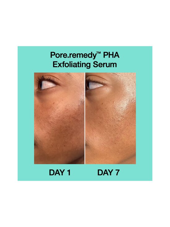 Dr.Jart+ - Pore Remedy PHA Exfoliating serums - NOCOL - photo 2 Dr.Jart+ - Pore Remedy PHA Exfoliating serums - NOCOL | Stockmann - photo 2