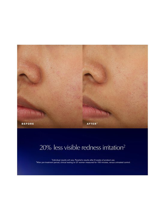 Estée Lauder - Advanced Night Repair Recovery Treatment Essence -hoitoneste - NOCOL | Stockmann - photo 8