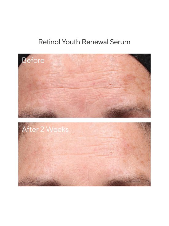 Murad - Retinol Youth Renewal -seerumi 30 ml - NOCOL - photo 3 Murad - Retinol Youth Renewal -seerumi 30 ml - NOCOL | Stockmann - photo 3