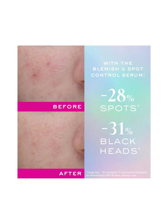 Nuxe - Zinc Power Blemish And Spot Control Serum -seerumi - NOCOL | Stockmann - photo 3