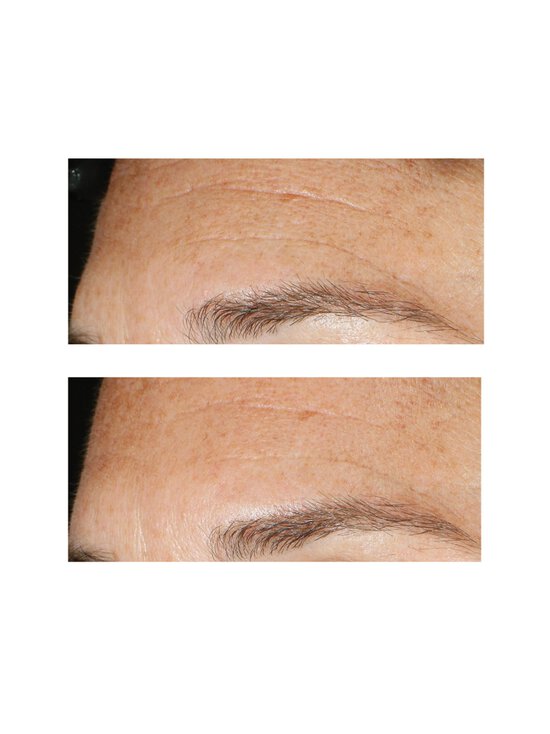 Murad - Happeline koorija Replenishing Multi-Acid Peel, 100 ml - NOCOL | Stockmann - photo 4