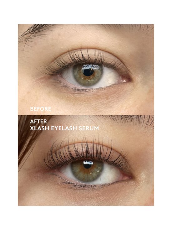 Xlash - Eyelash Serum -ripsiseerumi - WHITE | Stockmann - photo 5