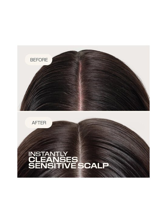 Goldwell - Dualsenses Scalp Specialist Sensitive Foam -shampoo - NOCOL | Stockmann - photo 3
