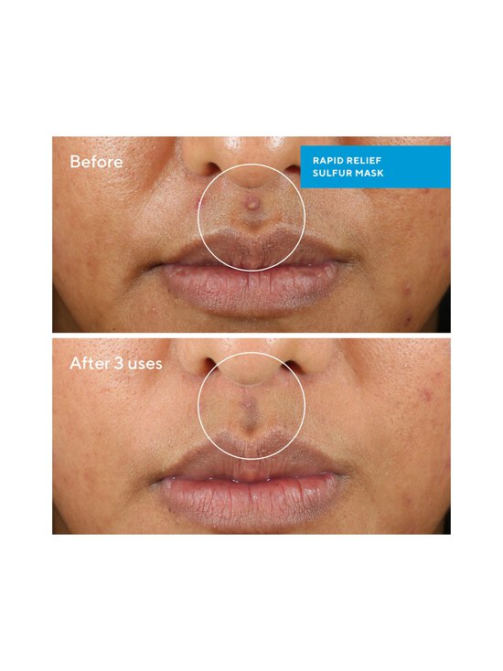 Murad - Rapid Relief Sulfur Mask -kasvonaamio - NOCOL | Stockmann - photo 2