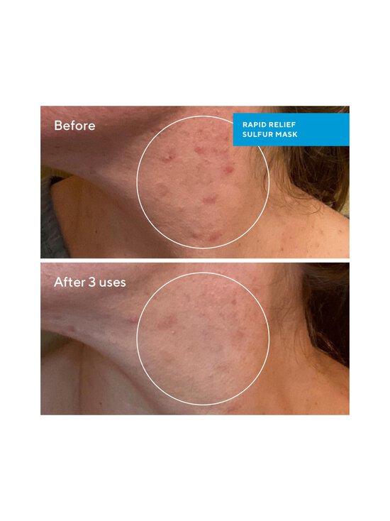 Murad - Rapid Relief Sulfur Mask -kasvonaamio - NOCOL | Stockmann - photo 3
