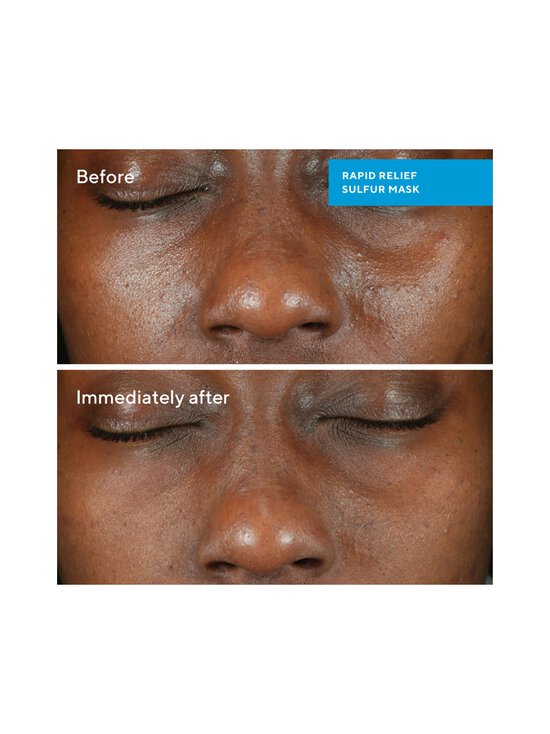 Murad - Rapid Relief Sulfur Mask -kasvonaamio - NOCOL | Stockmann - photo 4