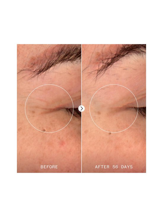 Pai - NAD+ Renewal sejas serums - NOCOL | Stockmann - photo 9