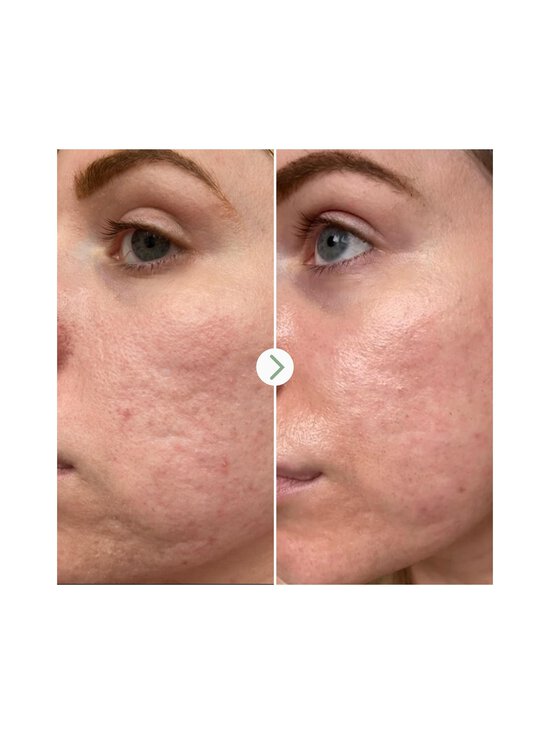 Pai Skincare - Hyaluronic Acid 0.3% Hydrating Booster -kasvoseerumi - NOCOL | Stockmann - photo 4