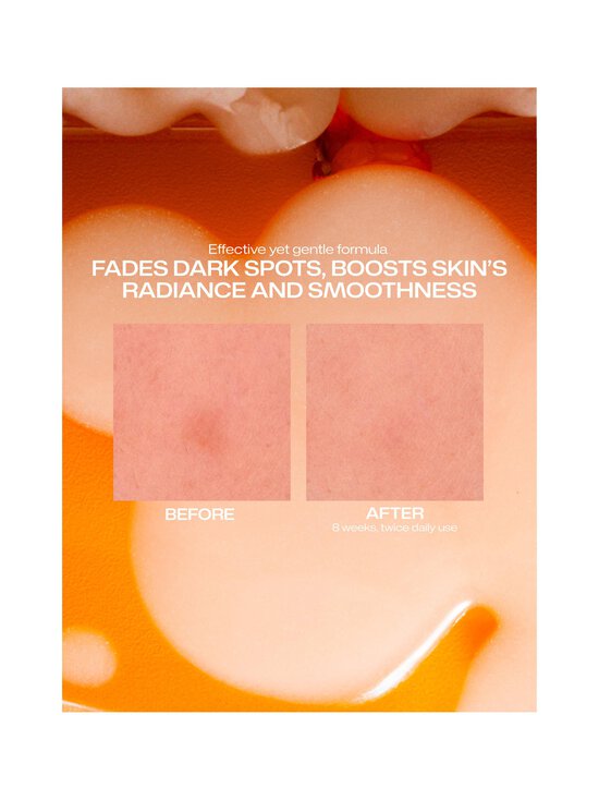 Lumene - Valo Dark Spot Serum -seerumi - NOCOL - photo 5 Lumene - Valo Dark Spot Serum -seerumi - NOCOL | Stockmann - photo 5