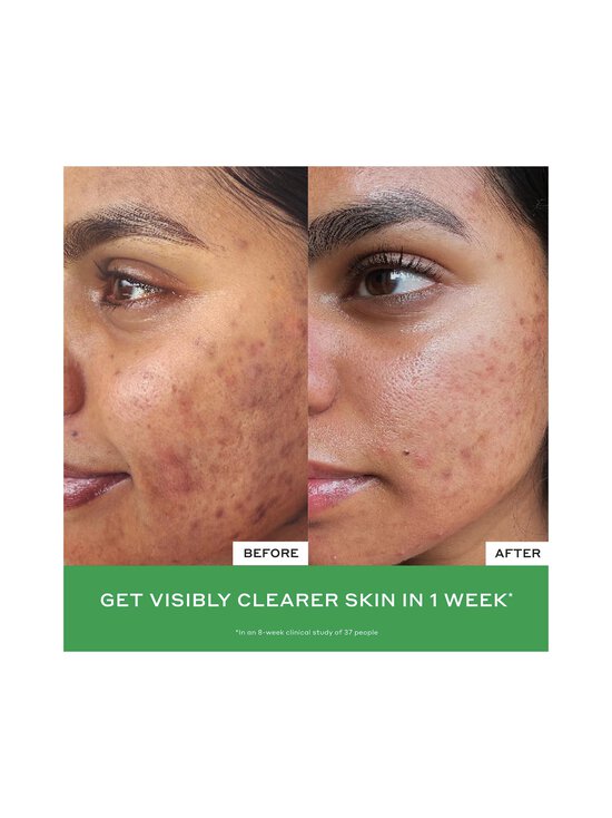 Ole Henriksen - Näomask Violet Ice Cold Plunge Pore Mask 90 g - NOCOL - photo 4 Ole Henriksen - Näomask Violet Ice Cold Plunge Pore Mask 90 g - NOCOL | Stockmann - photo 4