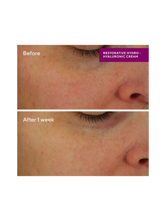 Murad - Restorative Hydro-Hyaluronic Cream -kasvovoide - NOCOL | Stockmann - photo 4