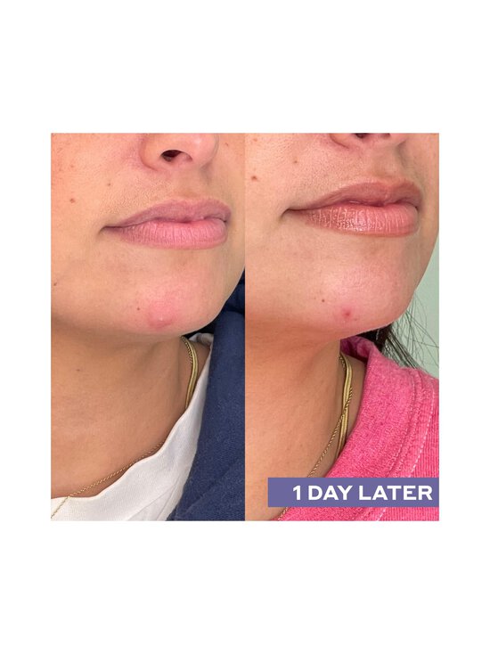 Mario Badescu - Repairing Facial Spray W/ Hypochlorous Acid - NOCOL - photo 8 Mario Badescu - Repairing Facial Spray W/ Hypochlorous Acid - NOCOL | Stockmann - photo 8