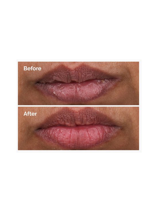 The Ordinary - PHA 5% Exfoliating Lip Serum lūpu serums - NOCOL - photo 3 The Ordinary - PHA 5% Exfoliating Lip Serum lūpu serums - NOCOL | Stockmann - photo 3